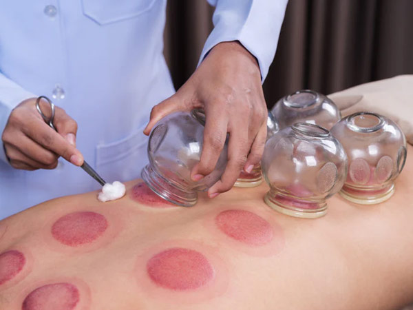 MAKBUL Konya  hacamat terapisi, hacamatçı, hacamat kursu, evden hacamat, hacamat fiyatı,